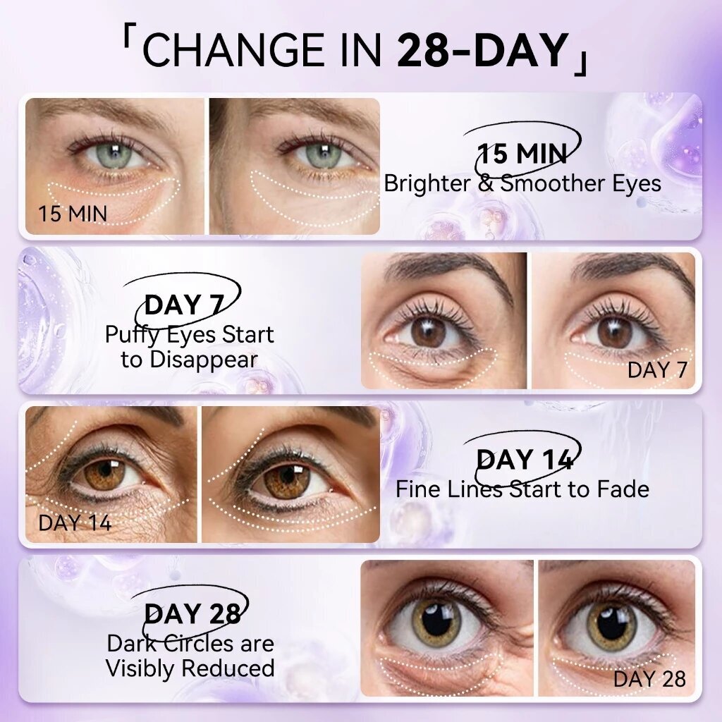 LANBENA Retinol Anti-Wrinkle E - Microneedle Patch Eye review and price